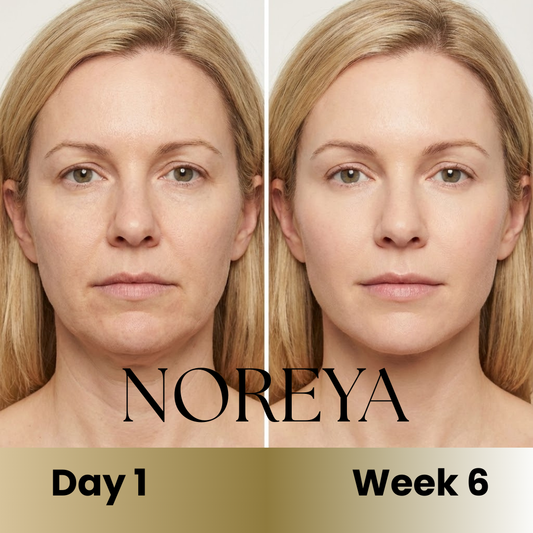 Noreya Sculptwave™