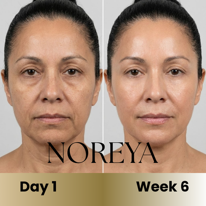 Noreya Sculptwave™