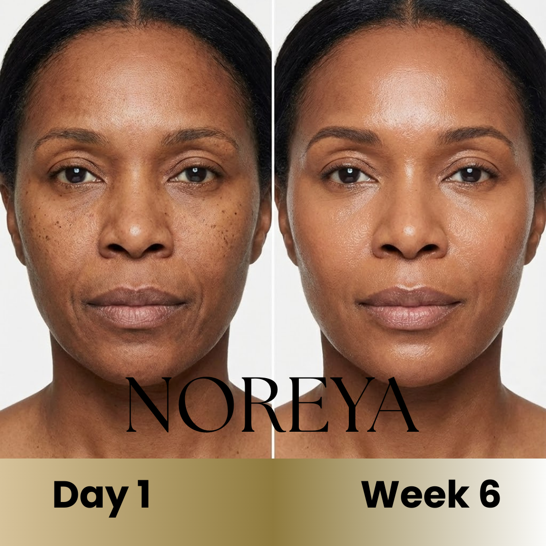 Noreya Sculptwave™