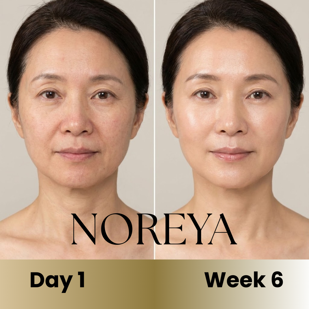 Noreya Sculptwave™