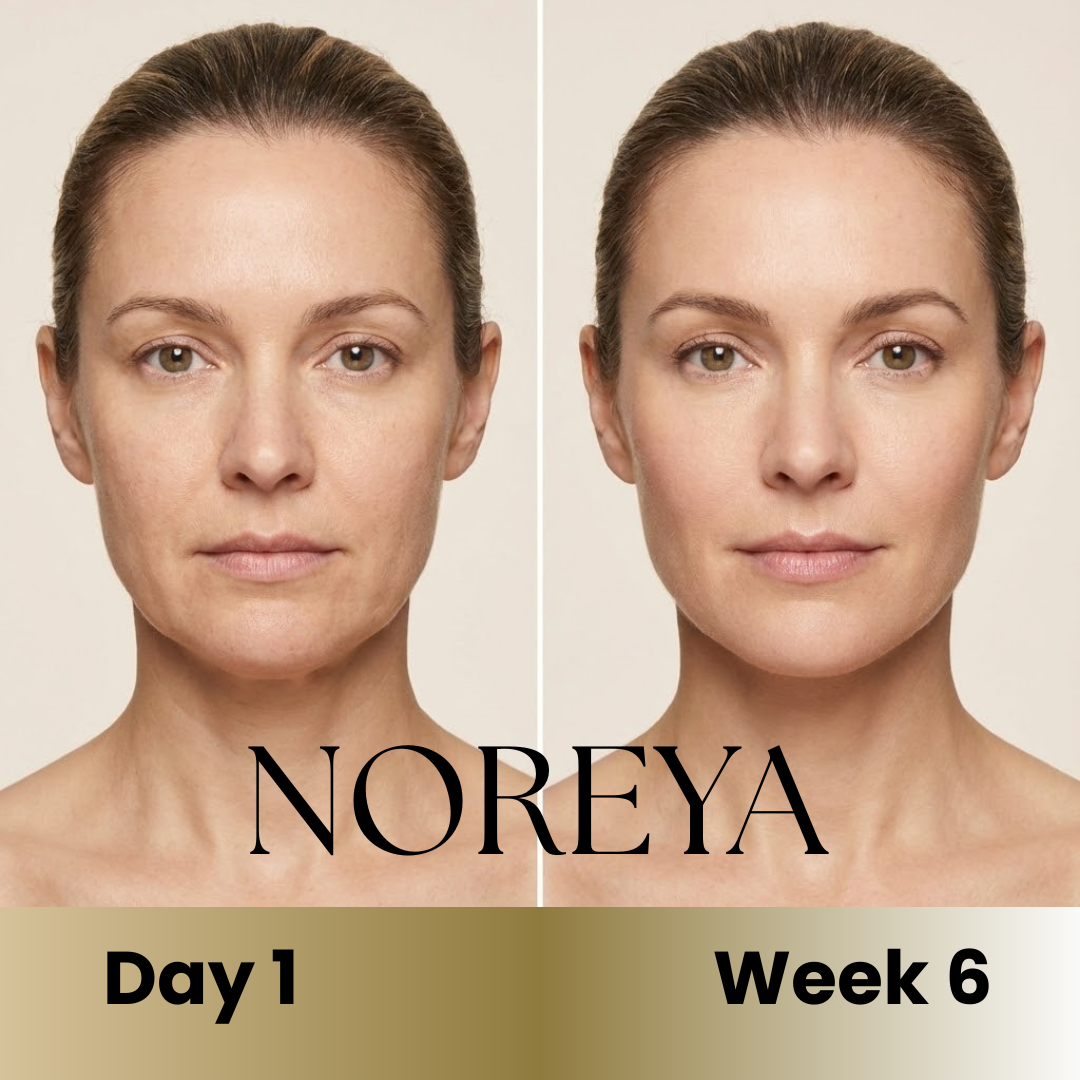 Noreya Sculptwave™