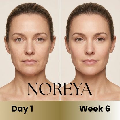 Noreya Sculptwave™