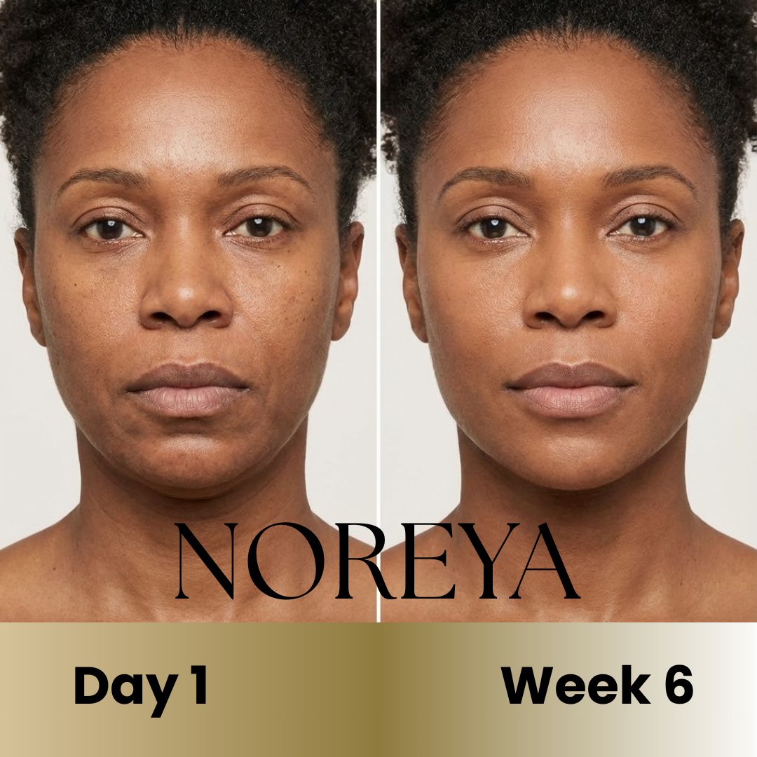 Noreya Sculptwave™