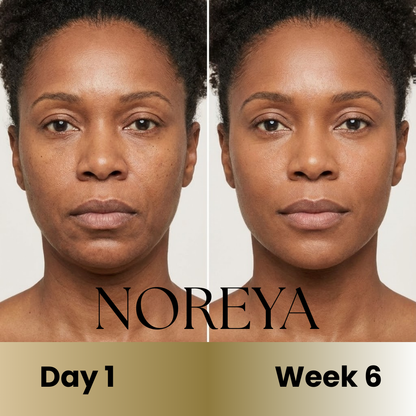 Noreya Sculptwave™